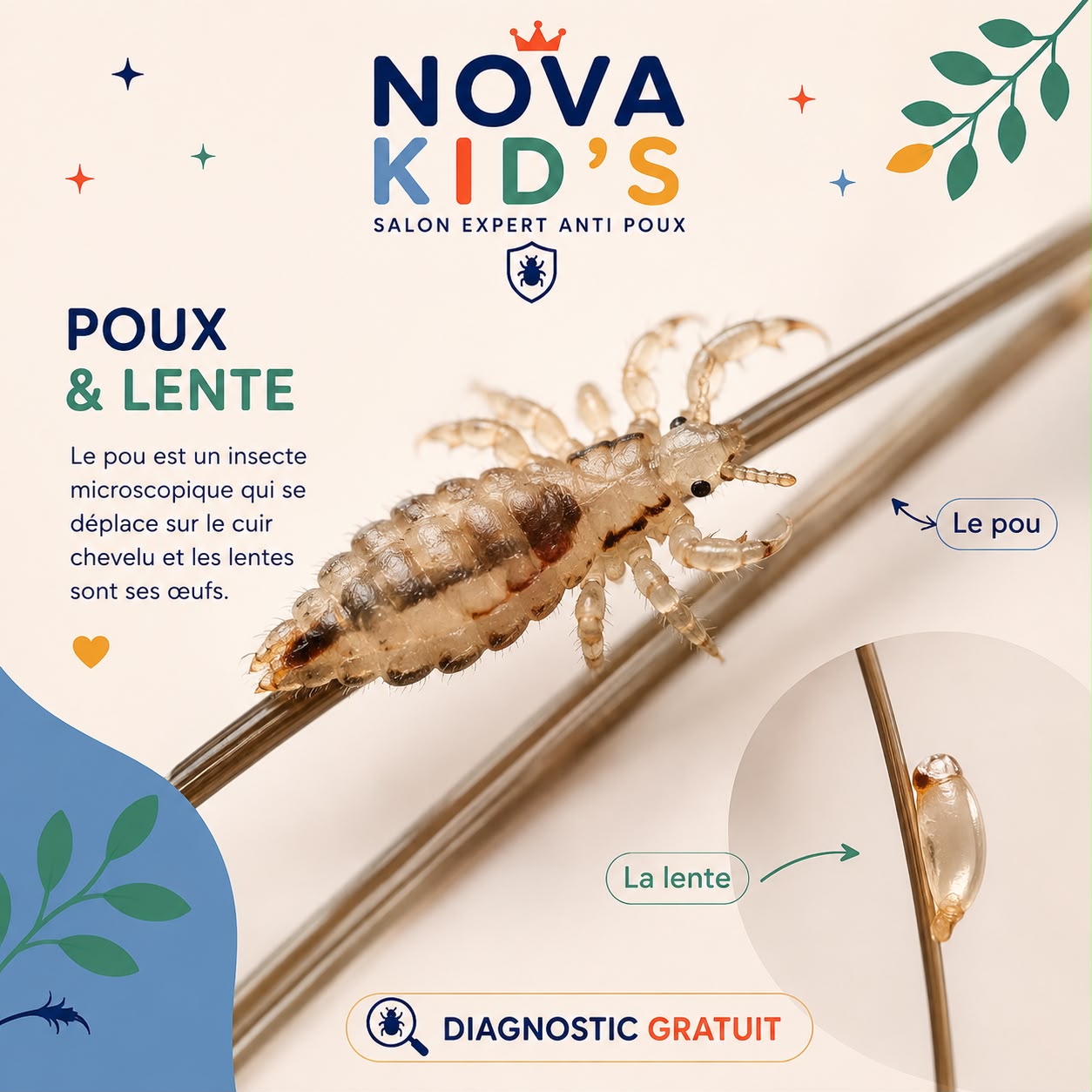 Poux et lentes : diagnostic NOVA KID’S